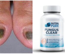 NutraPure Clear Fungus Review