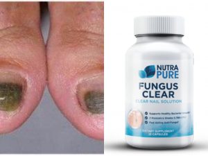 NutraPure Clear Fungus Review