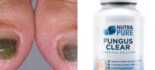 NutraPure Clear Fungus Review